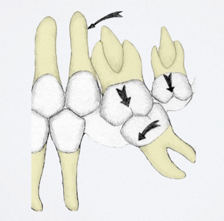 studio-dentistico-pagliani_cura-canalare_anatomia-dente-estrazione-09